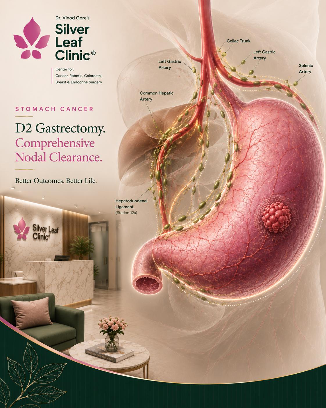 Rectal Cancer Surgery - Dr. Vinod T. Gore